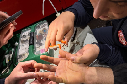 Yalova İtfaiyesi Parmakta Sıkışan Yüzüğü Güvenle Çıkardı!