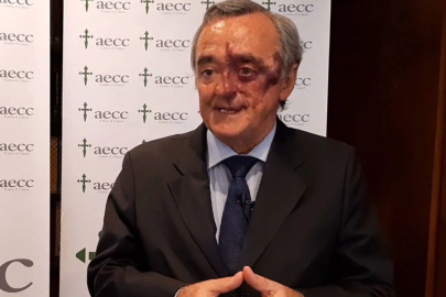 İspanya’dan Çarpıcı Araştırma: Pankreas Tümörü Yok Edildi!