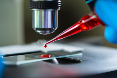 Gazi Üniversitesi’nden Türkiye’nin İlk Yerli Gen Tedavisi: Üretim Süreci Başladı!