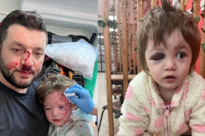 YALOVA’DA DEHŞET: 14 AYLIK BEBEK VE BABASI SOPAYLA DARBEDİLDİ