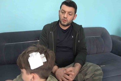 Yalova’da Komşu Kavgasında 8 Yaşındaki Çocuğa Taşlı Saldırı